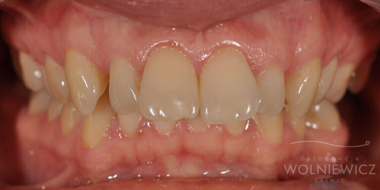 Metamorfoza 27 - przed